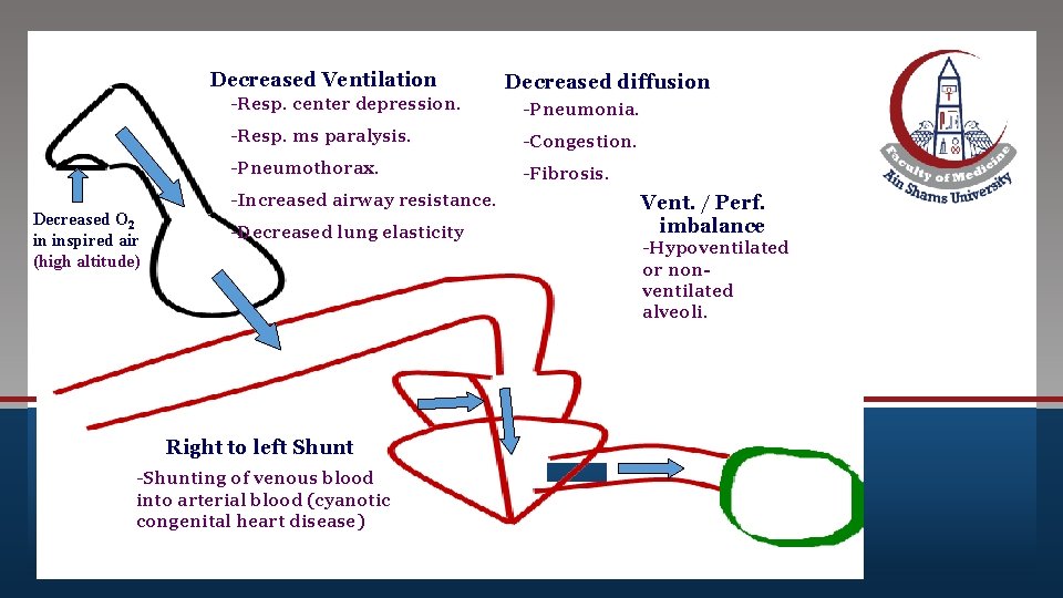 Click to edit Master title style Decreased Ventilation -Resp. center depression. -Resp. ms paralysis.