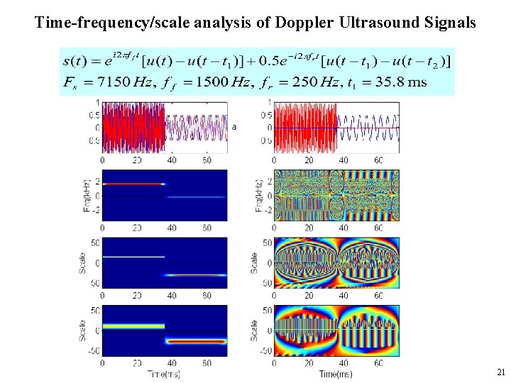 Time-frequency/scale analysis of Doppler Ultrasound Signals 21 