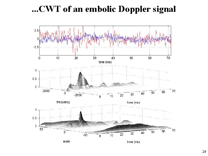 . . . CWT of an embolic Doppler signal 24 