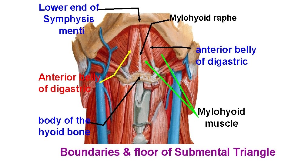 Lower end of Symphysis menti Mylohyoid raphe anterior belly of digastric Anterior belly of
