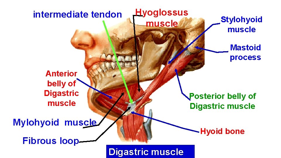 intermediate tendon Hyoglossus muscle Stylohyoid muscle Mastoid process Anterior belly of Digastric muscle Posterior