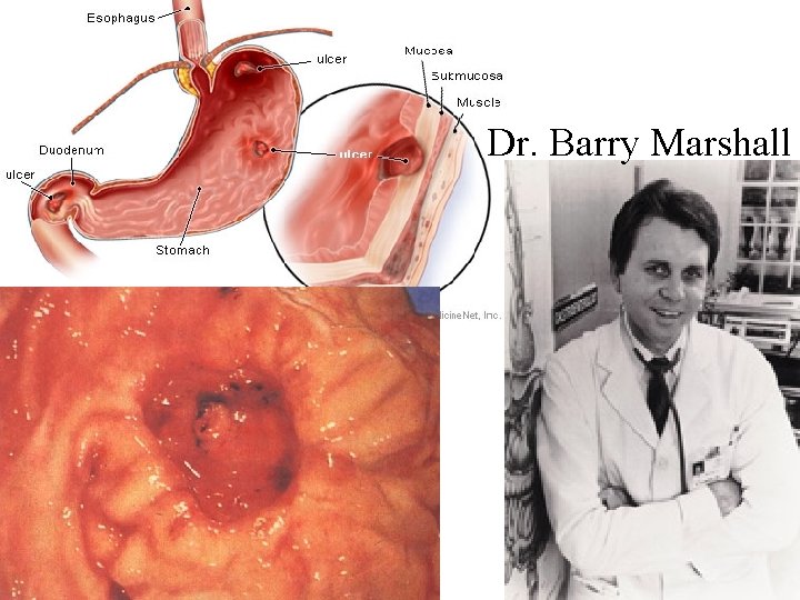 Dr. Barry Marshall Dr. Barry Marshall