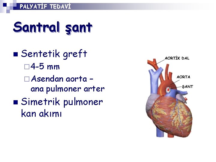 PALYATİF TEDAVİ Santral şant n Sentetik greft ¨ 4 -5 mm ¨ Asendan aorta