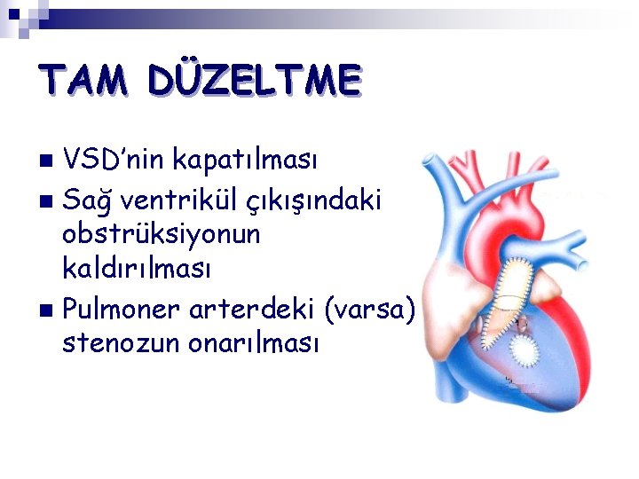 TAM DÜZELTME VSD’nin kapatılması n Sağ ventrikül çıkışındaki obstrüksiyonun kaldırılması n Pulmoner arterdeki (varsa)