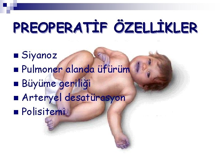 PREOPERATİF ÖZELLİKLER Siyanoz n Pulmoner alanda üfürüm n Büyüme geriliği n Arteryel desatürasyon n