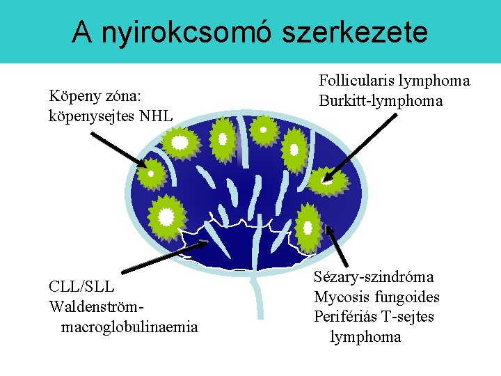 A nyirokcsomó szerkezete Köpeny zóna: köpenysejtes NHL CLL/SLL Waldenströmmacroglobulinaemia Follicularis lymphoma Burkitt-lymphoma Sézary-szindróma Mycosis