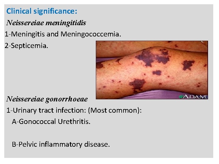 n Clinical significance: Neissereiae meningitidis 1 -Meningitis and Meningococcemia. 2 -Septicemia. Neissereiae gonorrhoeae 1