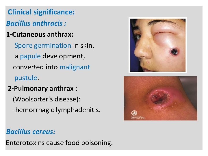 n Clinical significance: Bacillus anthracis : 1 -Cutaneous anthrax: Spore germination in skin, a