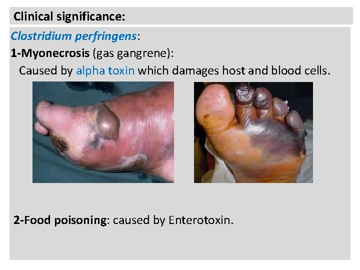 Clinical significance: Clostridium perfringens: 1 -Myonecrosis (gas gangrene): Caused by alpha toxin which damages