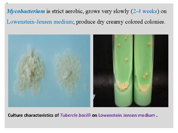 n Mycobacterium is strict aerobic, grows very slowly (2 -4 weeks) on Lowenstein-Jensen medium;