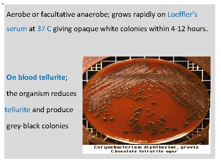 n Aerobe or facultative anaerobe; grows rapidly on Loeffler’s serum at 37 C giving