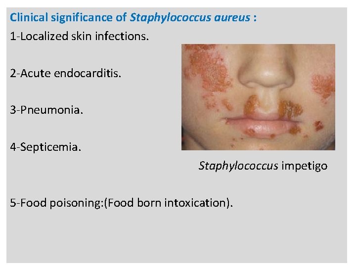 n Clinical significance of Staphylococcus aureus : 1 -Localized skin infections. 2 -Acute endocarditis.