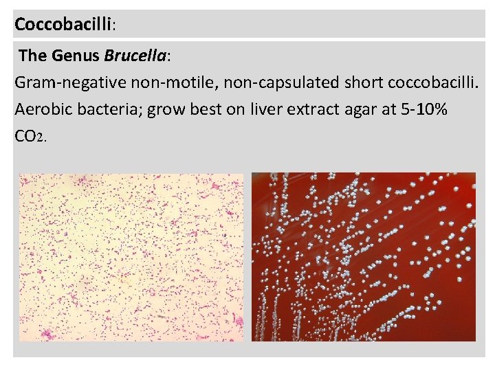 Coccobacilli: The Genus Brucella: Gram-negative non-motile, non-capsulated short coccobacilli. Aerobic bacteria; grow best on