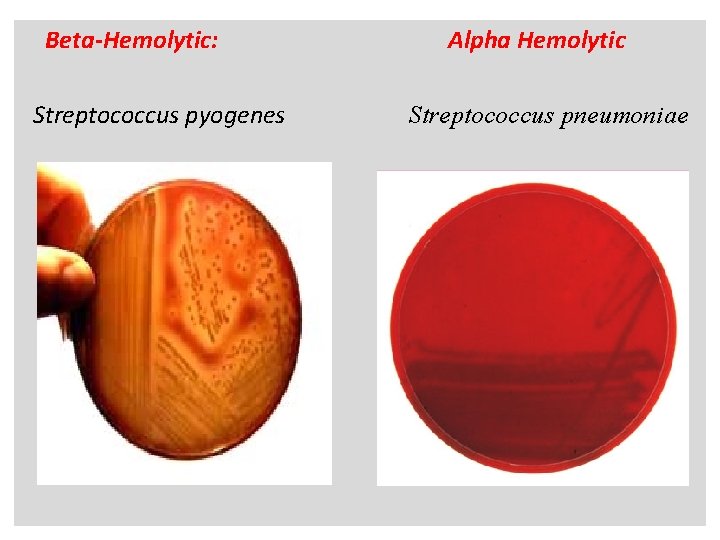 n Beta-Hemolytic: Streptococcus pyogenes Alpha Hemolytic Streptococcus pneumoniae 