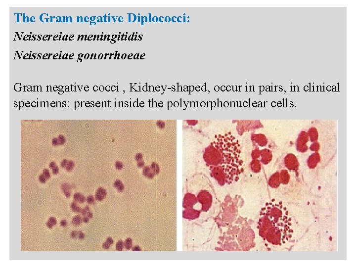 n The Gram negative Diplococci: Neissereiae meningitidis Neissereiae gonorrhoeae Gram negative cocci , Kidney-shaped,