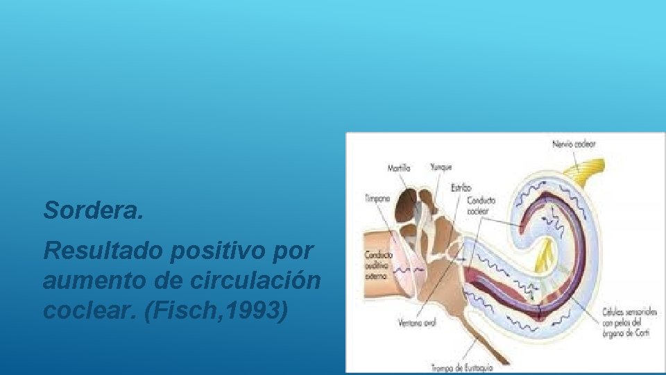 Sordera. Resultado positivo por aumento de circulación coclear. (Fisch, 1993) 