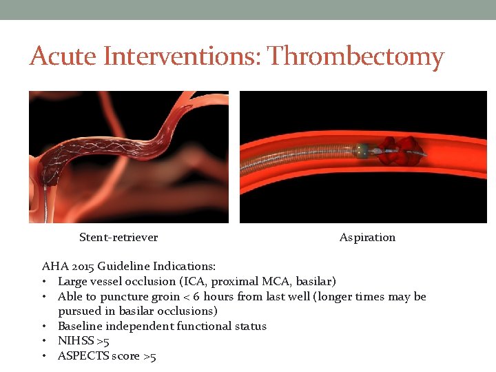 Acute Interventions: Thrombectomy Stent-retriever Aspiration AHA 2015 Guideline Indications: • Large vessel occlusion (ICA,