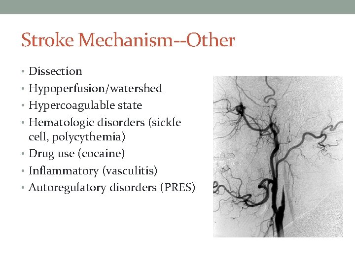 Stroke Mechanism--Other • Dissection • Hypoperfusion/watershed • Hypercoagulable state • Hematologic disorders (sickle cell,