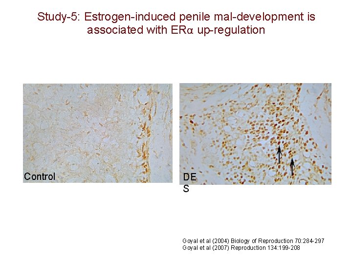 Study-5: Estrogen-induced penile mal-development is associated with ERα up-regulation Control DE S Goyal et