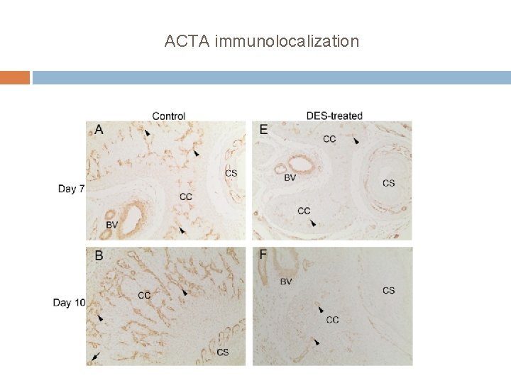 ACTA immunolocalization 