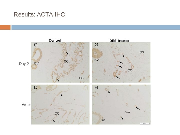 Results: ACTA IHC Control DES-treated 