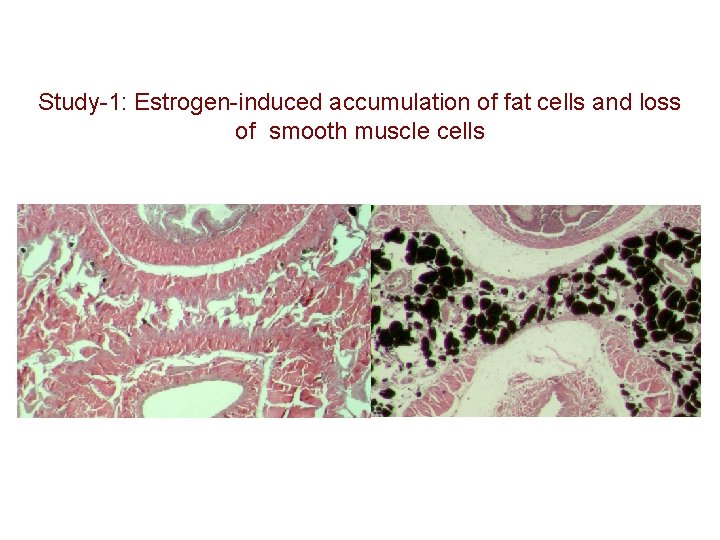 Study-1: Estrogen-induced accumulation of fat cells and loss of smooth muscle cells Control DE