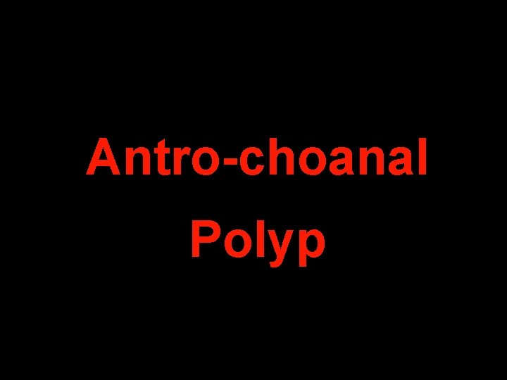 Antro-choanal Polyp 