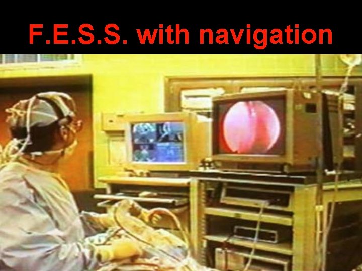 F. E. S. S. with navigation 