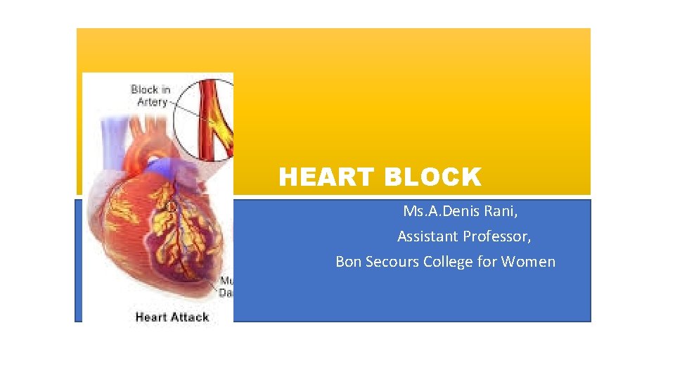 HEART BLOCK Ms. A. Denis Rani, Assistant Professor, Bon Secours College for Women 