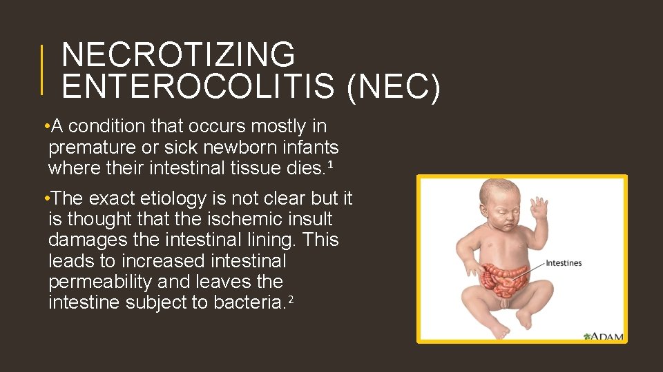 NECROTIZING ENTEROCOLITIS (NEC) • A condition that occurs mostly in premature or sick newborn