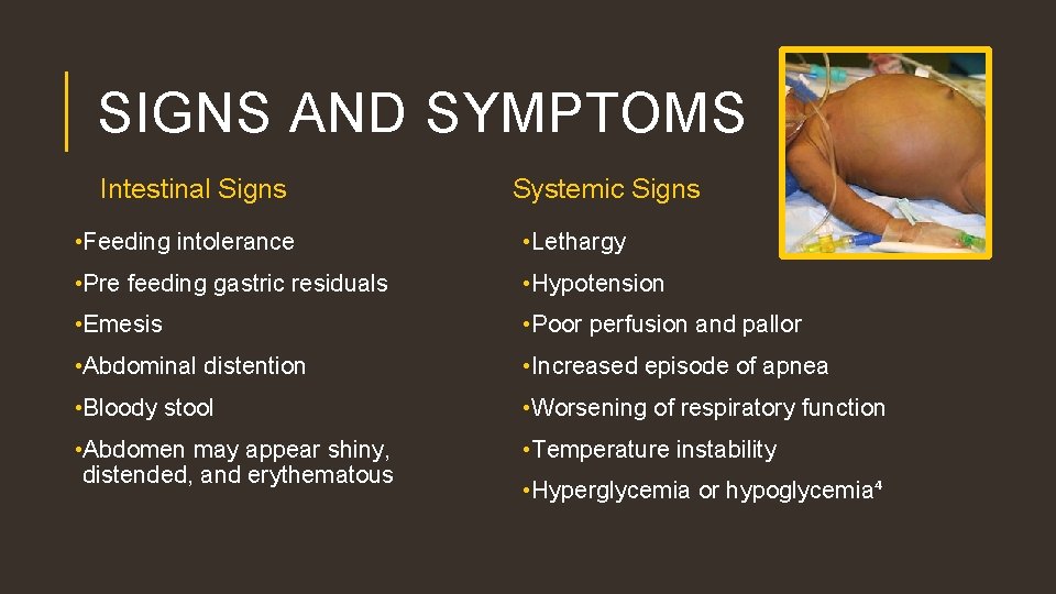 SIGNS AND SYMPTOMS Intestinal Signs Systemic Signs • Feeding intolerance • Lethargy • Pre