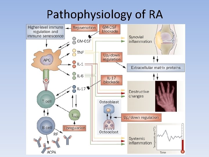 Pathophysiology of RA 
