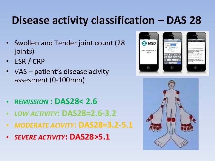 Disease activity classification – DAS 28 • Swollen and Tender joint count (28 joints)