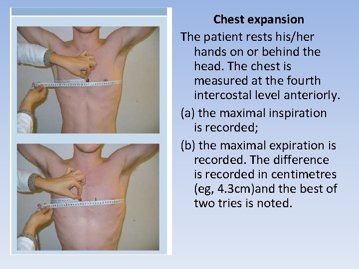 Chest expansion The patient rests his/her hands on or behind the head. The chest