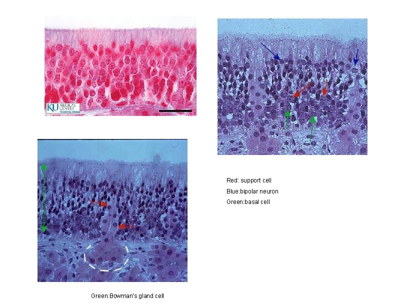 Red: support cell Blue: bipolar neuron Green: basal cell Green: Bowman’s gland cell 