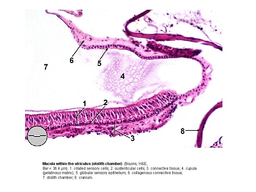 Macula within the utriculus (otolith chamber) (Bouins, H&E, Bar = 36. 4 µm). 1.