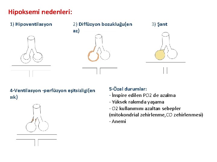 Hipoksemi nedenleri: 1) Hipoventilasyon 2) Diffüzyon bozukluğu(en az) 4 -Ventilasyon -perfüzyon eşitsizligi(en sık) 3)