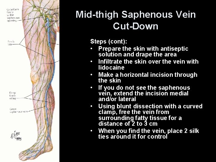 Mid-thigh Saphenous Vein Cut-Down Steps (cont): • Prepare the skin with antiseptic solution and