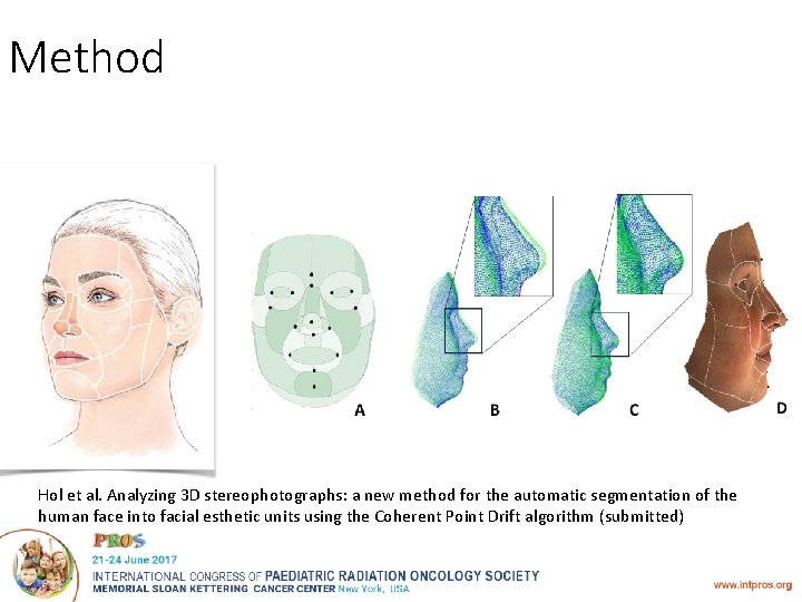 Method Hol et al. Analyzing 3 D stereophotographs: a new method for the automatic