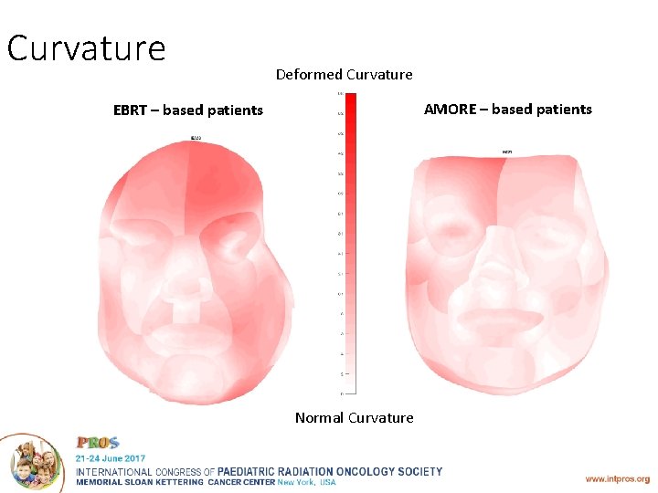 Curvature Deformed Curvature AMORE – based patients EBRT – based patients Normal Curvature 