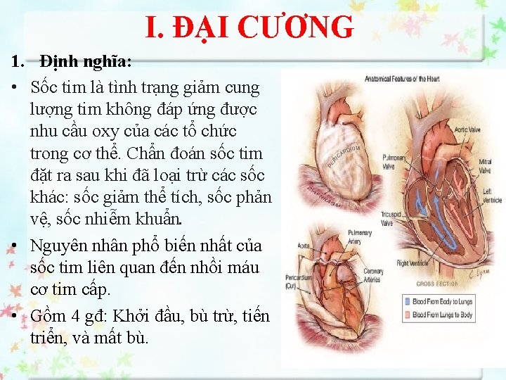 I. ĐẠI CƯƠNG 1. Định nghĩa: • Sốc tim là tình trạng giảm cung