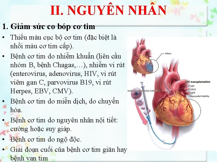 II. NGUYÊN NH N 1. Giảm sức co bóp cơ tim • Thiếu máu