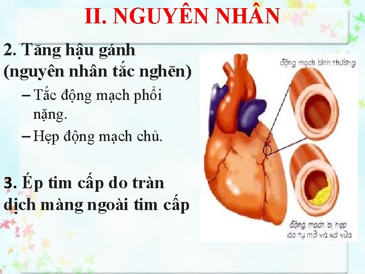 II. NGUYÊN NH N 2. Tăng hậu gánh (nguyên nhân tắc nghẽn) – Tắc
