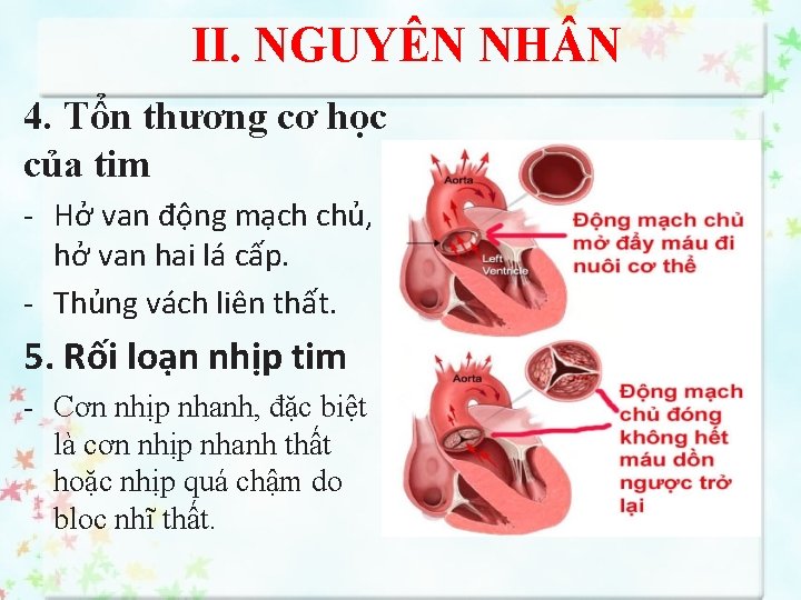 II. NGUYÊN NH N 4. Tổn thương cơ học của tim - Hở van