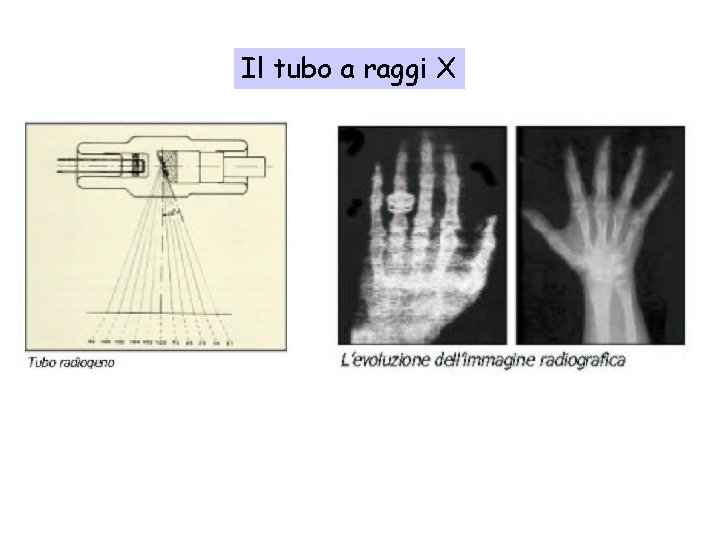 Il tubo a raggi X 