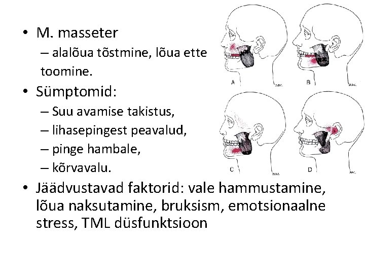  • M. masseter – alalõua tõstmine, lõua ette toomine. • Sümptomid: – Suu