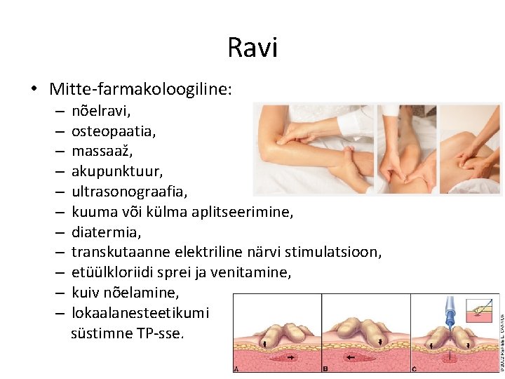 Ravi • Mitte-farmakoloogiline: – – – nõelravi, osteopaatia, massaaž, akupunktuur, ultrasonograafia, kuuma või külma