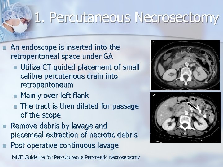 1. Percutaneous Necrosectomy n n n An endoscope is inserted into the retroperitoneal space