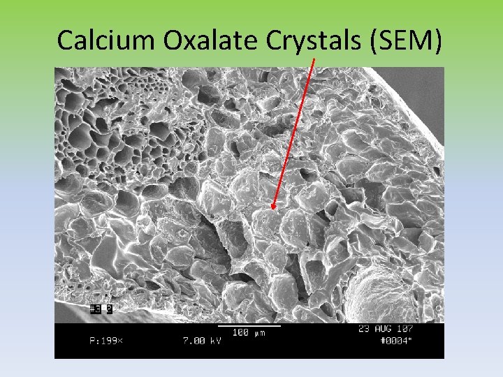 Calcium Oxalate Crystals (SEM) 