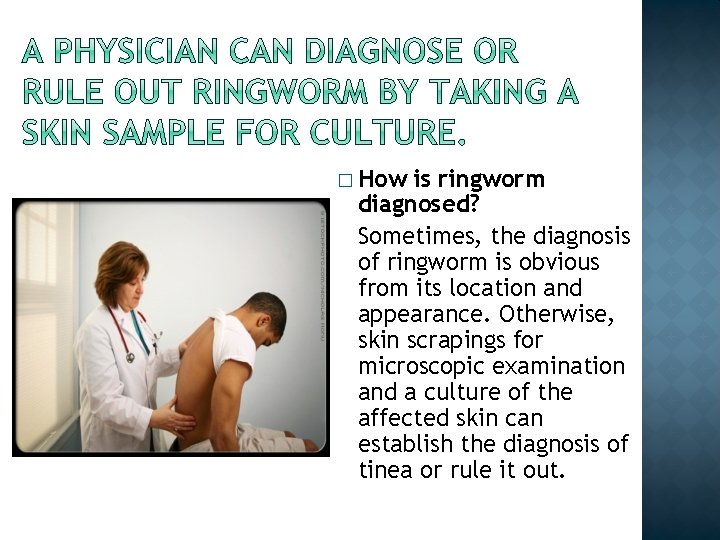� How is ringworm diagnosed? Sometimes, the diagnosis of ringworm is obvious from its � How is ringworm diagnosed? Sometimes, the diagnosis of ringworm is obvious from its